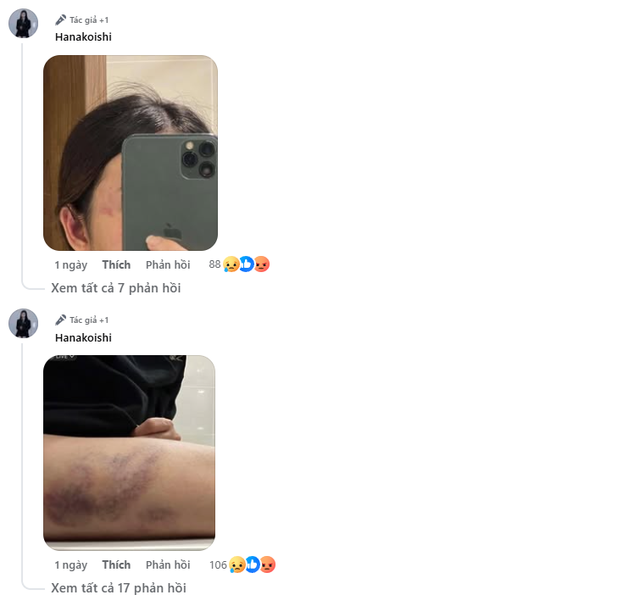 Nữ streamer xinh đẹp tiết lộ bị "tác động vật lý" nặng nề, thủ phạm lại là người kề cận bên cạnh- Ảnh 3. Nữ streamer xinh đẹp tiết lộ bị "tác động vật lý" nặng nề, thủ phạm lại là người kề cận bên cạnh- Ảnh 3.