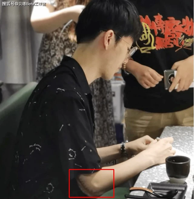 Chấn thương tay rất nặng của TheShy