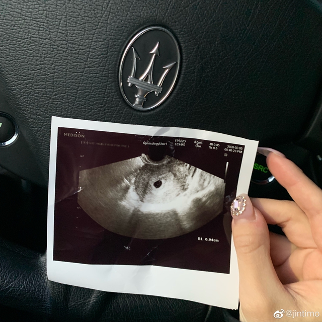 LMHT: Trong khi Faker còn đang ế chỏng chơ thì Xạ thủ mỹ nam của Afreeca 3 năm làm liền 2 cháu, bảo sao T1 chẳng toang - Ảnh 3. LMHT: Trong khi Faker còn đang ế chỏng chơ thì Xạ thủ mỹ nam của Afreeca 3 năm làm liền 2 cháu, bảo sao T1 chẳng toang - Ảnh 3.